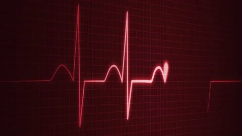 Abstract ECG Animation with Beating Pulse Line for Scientific and Medical E.. Stock Footage 310209943