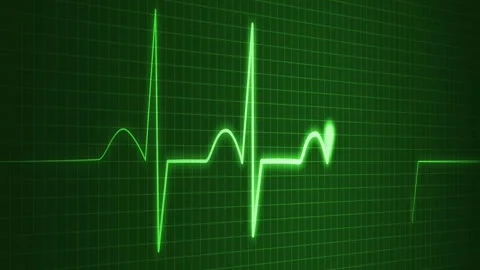 Abstract ECG Animation with Beating Pulse Line for Scientific and Medical E.. Vídeos de archivo 310210027