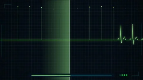 Abstract green digital data visualization lines on dark background technolo.. Stock Footage 344641339