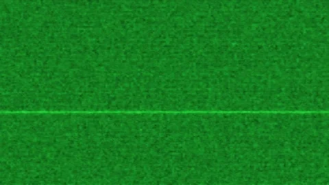 Abstract Green Digital Noise and Static Grain Texture with Glitch Effect Stock Footage 345756038