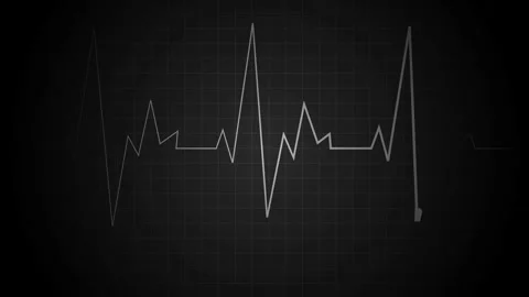 Abstract heart rate line grid with a single pulse spike medical monitor sty.. Stock Footage 340384174