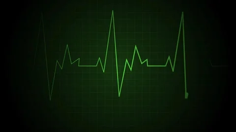 Abstract heart rate line grid with a single pulse spike medical monitor sty.. Stock Footage 340384195