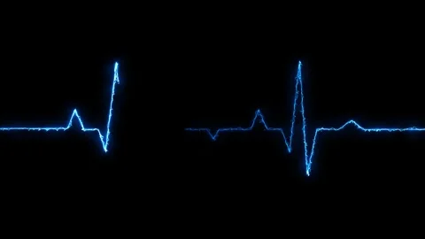 Abstract heartbeat and pulse rate on black background. Heart bit signal ani.. Stock Footage 304190064