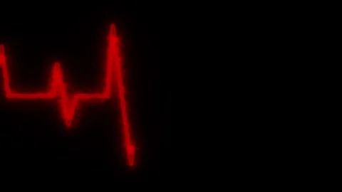 Abstract heartbeat and pulse rate animation. Stock Footage 309845506