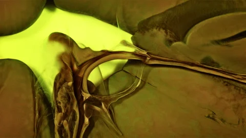 Abstract Ink Paint Diffusion Paradox Illusion Shapes Video stock 308996502