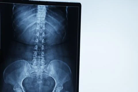 Abstract light xrays Stock Photos