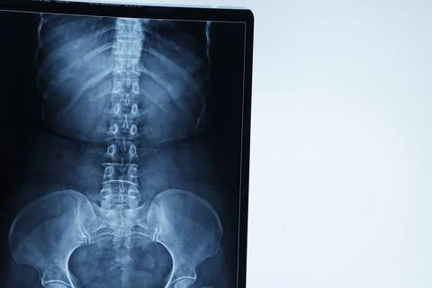Abstract light xrays Stock Photos