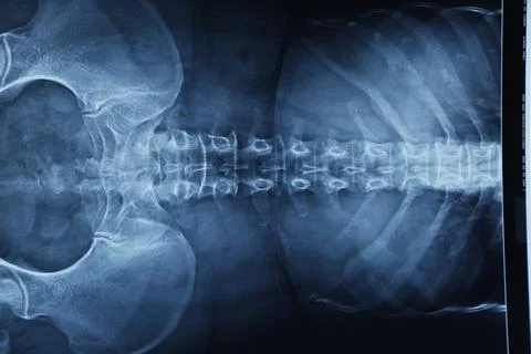 Abstract light xrays Stock Photos