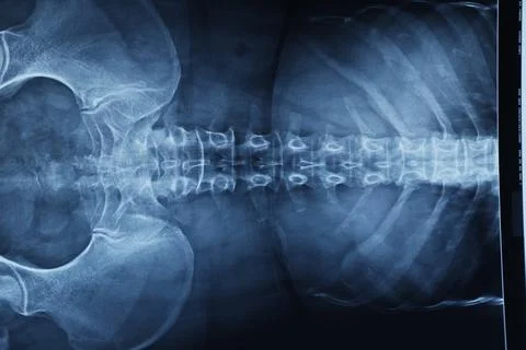 Abstract light xrays Stock Photos