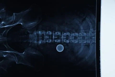 Abstract light xrays Stock Photos