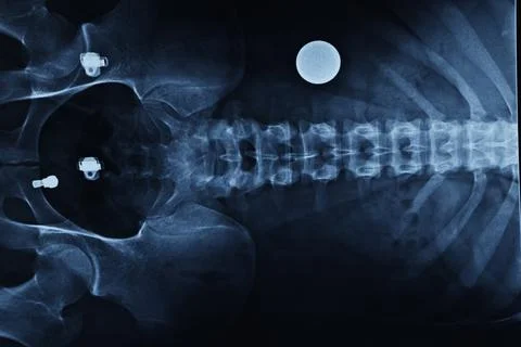 Abstract light xrays Stock Photos
