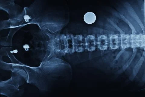 Abstract light xrays Stock Photos