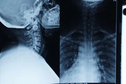 Abstract light xrays Stock Photos