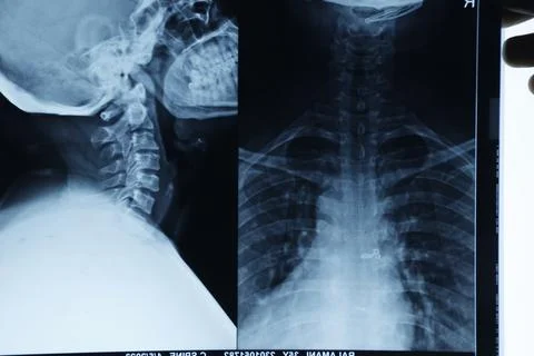 Abstract light xrays Stock Photos