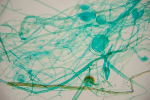 Abstract microscopic image of blue-green algae with intricate patterns and .. Foto stock
