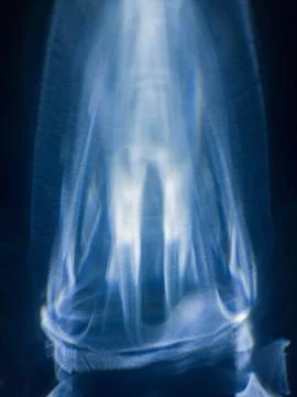 Abstract reflection of a blue plastic bottle on the wall. Stock-Fotos