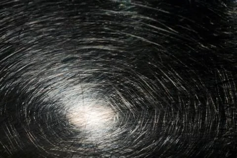 Abstract scratch on metal Stock Photos