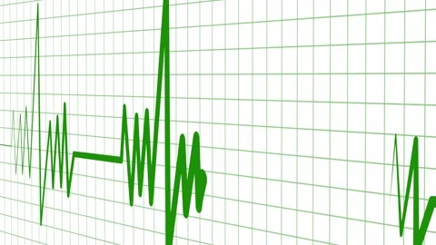 Abstract Sound Wave on Grid Background Видео 317646746