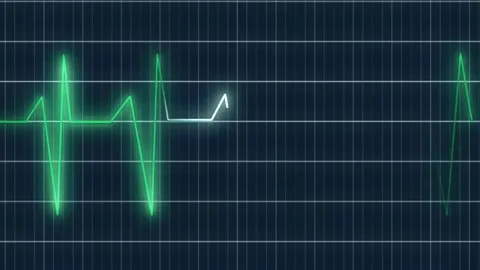 Abstract ventilator green waves waving animation Video stock 255886558