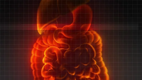 Abstract x-ray image of the digestive system, stomach and intestines. Stock Footage 141741317