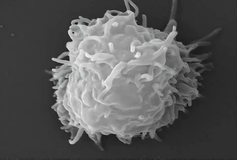 Acanthamoeba polyphaga This scanning electron microscope (SEM) image reve... Stock Photos
