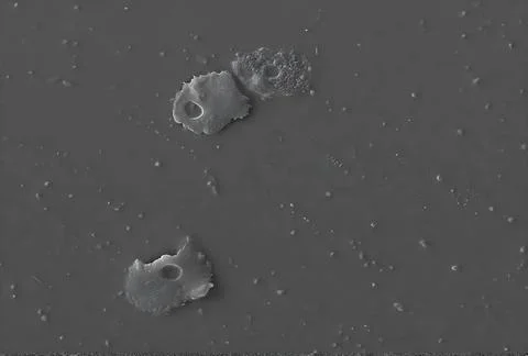  Acanthamoeba polyphaga This scanning electron microscope (SEM) image reve... Stock Photos