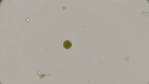 Acanthocystis, heliozoa under the microscope Stock Footage 92675333