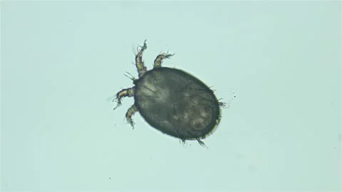 Acari (mite) Deutonymph under the microscope, of the Histiostomatidae family Stock Footage 143920213