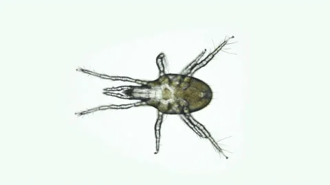 Acari mite Mesostigmata under microscope, Parasitoidea Superfamily. Predator Stock Footage 157495790
