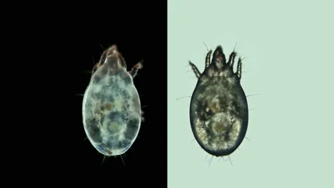 Acari (mite) of the order Sarcoptiformes under the microscope, family Acaridae Stock Footage 146543012