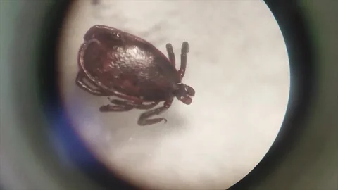 Acari mite under microscope. Ixodes tick. Tick-borne disease Stock Footage 252138563