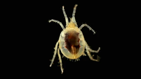 Acari(mite) living in water under a microscope, the superfamily Halacaroidea Stock Footage 140020194
