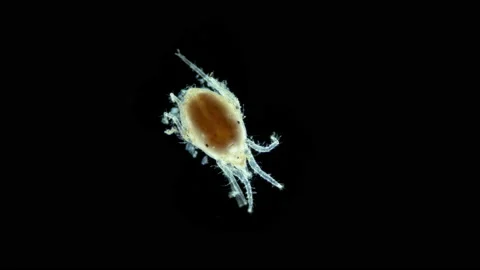 Acari(mite) living in water under a microscope, superfamily Halacaroidea Stock Footage 234053545