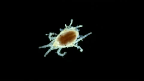 Acari(mite) living in water under a microscope, the superfamily Halacaroidea Stock Footage 234054538