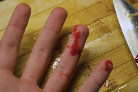 Accidental Finger Cut While Cooking in Kitchen Stock Photos