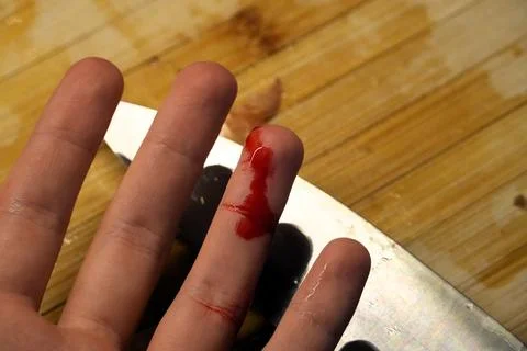 Accidental Finger Cut While Cooking in Kitchen Stock Photos