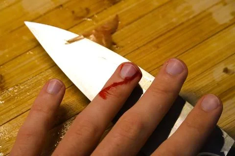 Accidental Finger Cut While Cooking in Kitchen Stock Photos