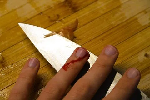 Accidental Finger Cut While Cooking in Kitchen Stock Photos