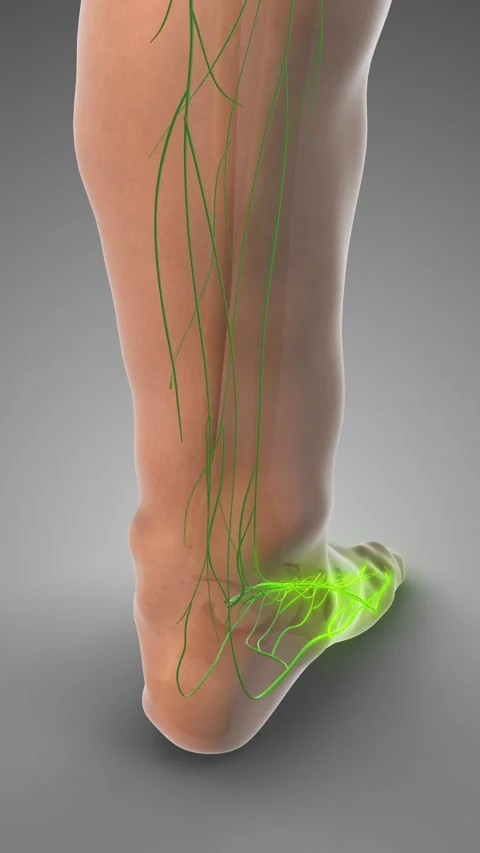 Accumulated Fluid Triggering Pitting Edema Stock Footage 310712048
