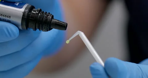 Accurate application of the adhesive, for veneers, on the plastic applicator Stockbeeldmateriaal 233247681