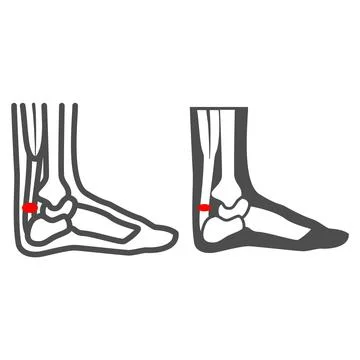 Achilles heel line and solid icon, Human diseases concept, leg with a sore ankle イラスト素材