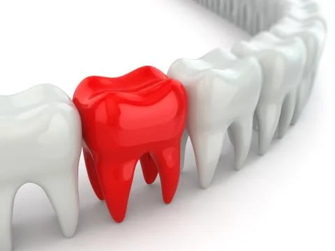 Aching tooth in row of healthy teeth. Stock Illustration