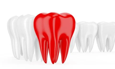 Aching tooth in row of healthy teeth. 3d Illustrazione stock