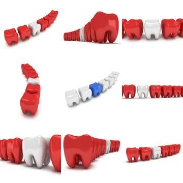 Aching tooth in row of healthy teeth Stock Illustration