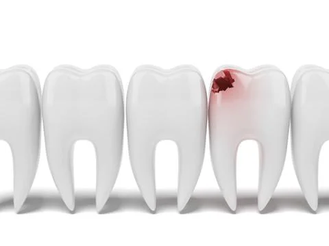 Aching tooth in row of healthy teeth イラスト素材