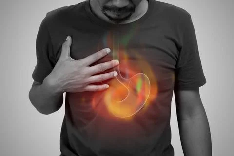 Acid reflux. Stock Photos