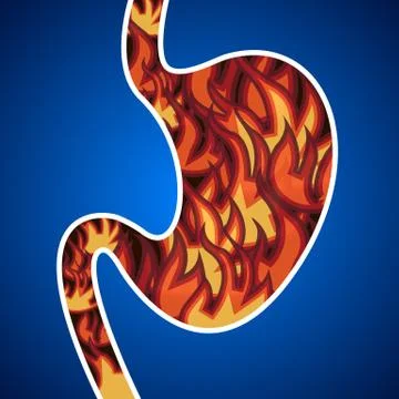 Acid in the stomach. Stock Illustration