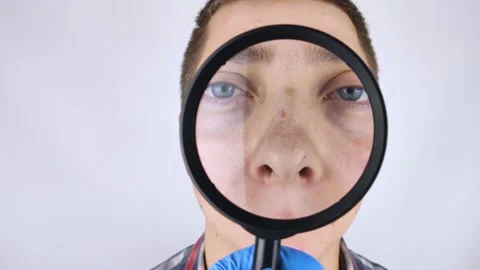 Acne and black dots close-up. A man is being examined by a doctor. Dermatologist Stock-Footage 142731815