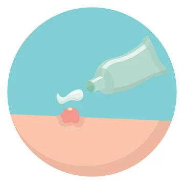 Acne and breakout solution. Stock Illustration