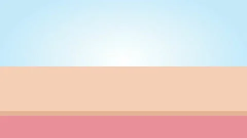 Acne and Pimples, stages of development, graphic animation Stock Footage 133119237